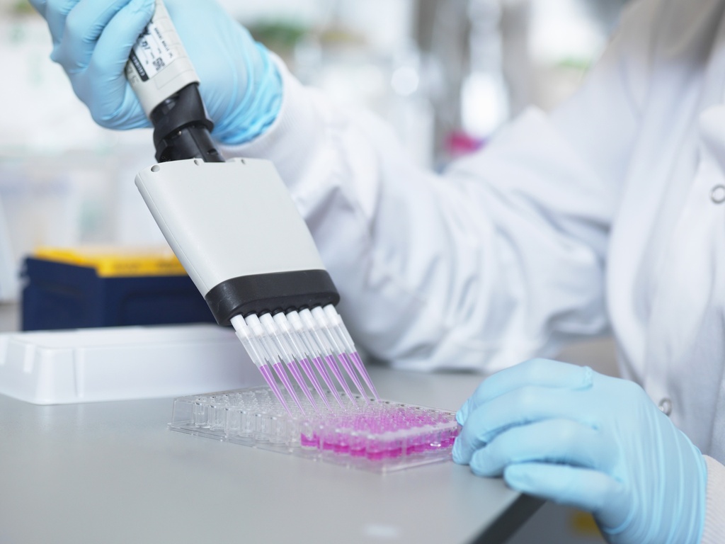   IgG ELISA Kit   